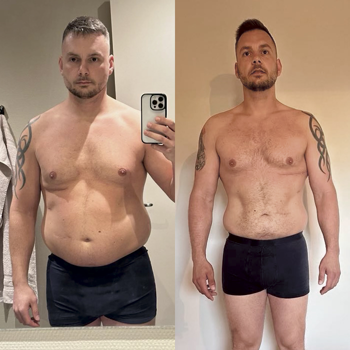 kunde før og efter vores vægttabsforløb med vægttabsmedicin