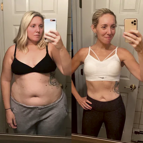 kunde før og efter vores vægttabsforløb med vægttabsmedicin