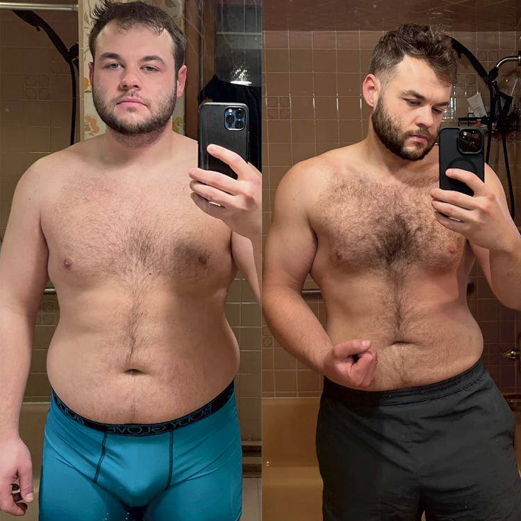 kunde før og efter vores vægttabsforløb med vægttabsmedicin